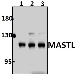 MASTL (F850)