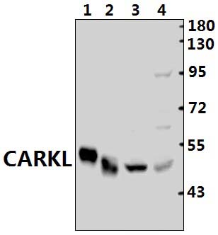 CARKL (A53)
