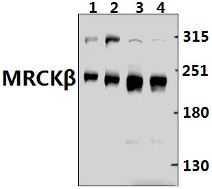 MRCKβ (F1665)