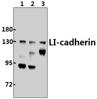 LI~cadherin (T363)