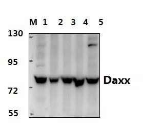 Daxx (D384)