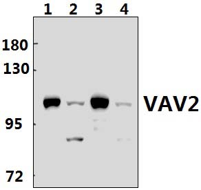 VAV2 (D138)