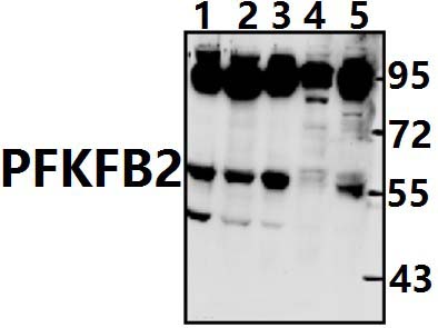 PFKFB2 (Y14)
