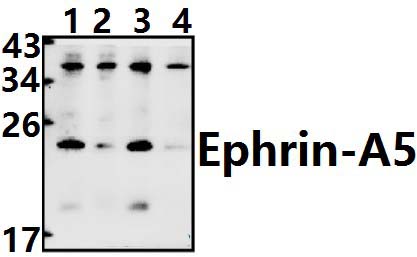 Ephrin~A5 (P63)
