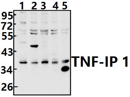 TNF~IP 1 (S122)
