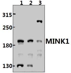 MINK1 (R406)