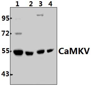 CaMKV (N217)