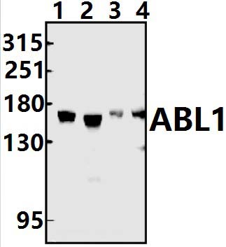 ABL1 (E883)