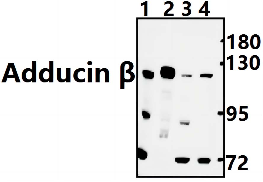 Adducin β (E497)