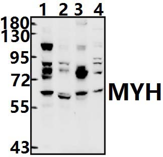 MYH (Y176)