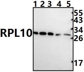 RPL10 (F34)