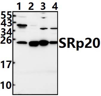SRp20 (F151)
