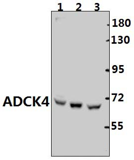 ADCK4 (G55)