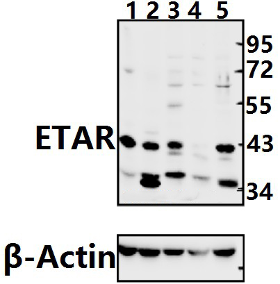 ETAR (N427)