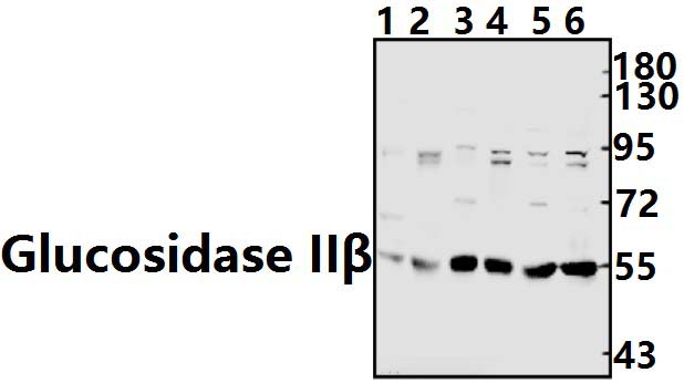 Glucosidase IIβ (K117)