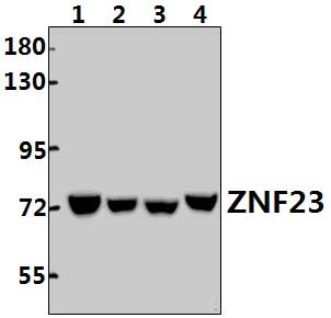 ZNF23 (Q185)