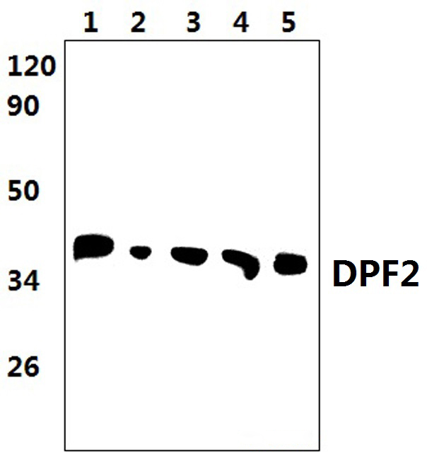 DPF2 (E174)