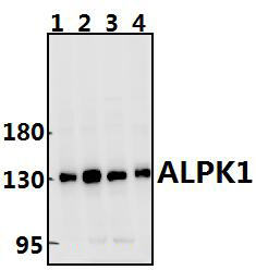 ALPK1