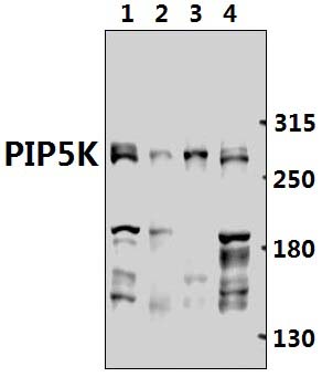 PIP5K (Q95)