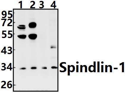 Spindlin~1 (H139)