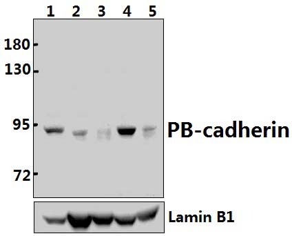 PB~cadherin (T134)