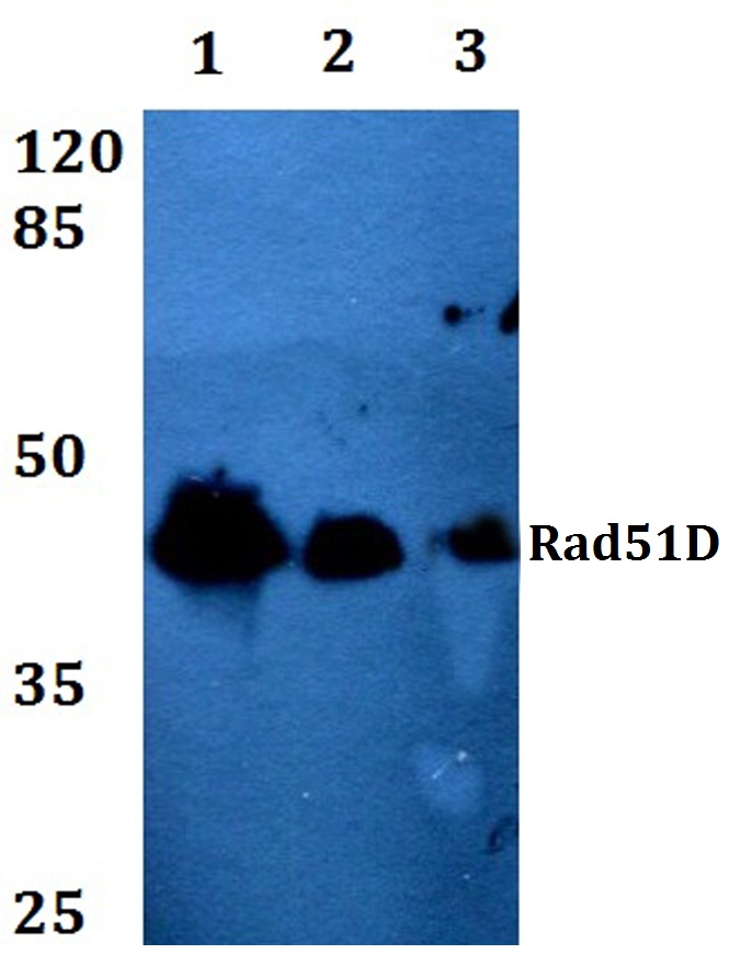 Rad51D (A152)