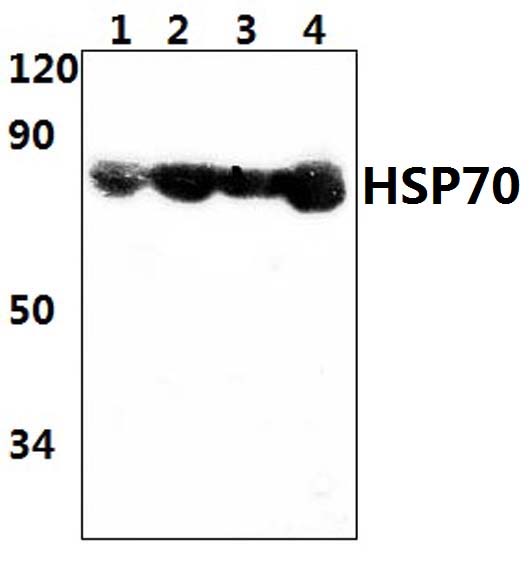 HSP70 (Y41)