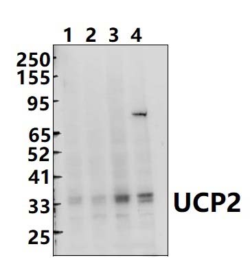 UCP2 (H113)