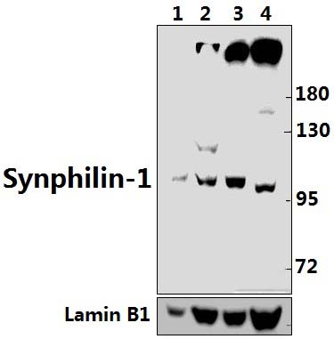 Synphilin~1 (R846)