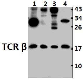 TCR β (K115)