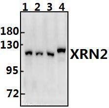 XRN2