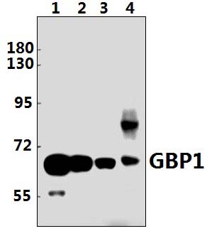GBP1 (E99)