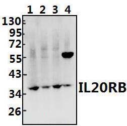IL20RB