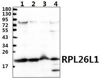 RPL26L1 (E145)