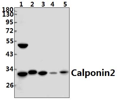 Calponin 2 (D156)