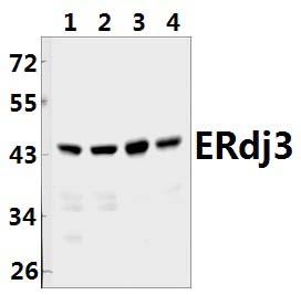 ERdj3 (K66)