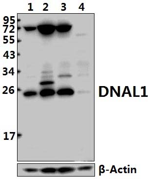 DNAL1 (N161)