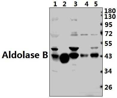 Aldolase B (W148)
