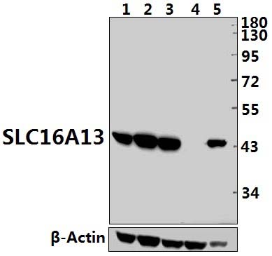 SLC16A13 (L423)