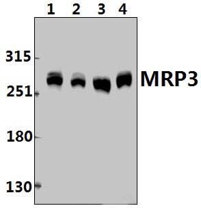 MRP3 (L1010)