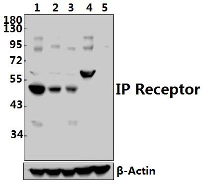 IP Receptor (H237)