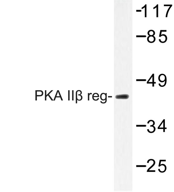 PKA IIβ reg (T109)