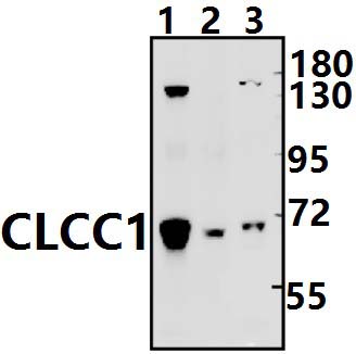 CLCC1 (D429)