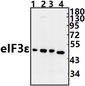 eIF3ε (V116)