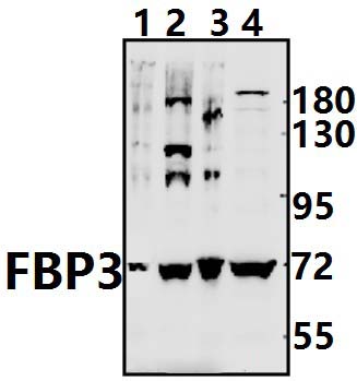 FBP3 (R241)