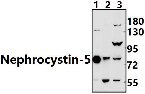 Nephrocystin~5 (R467)