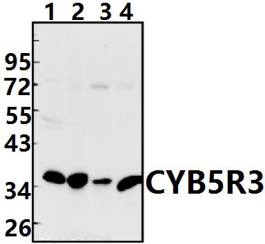 CYB5R3 (I169)