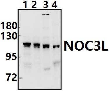 NOC3L (F447)