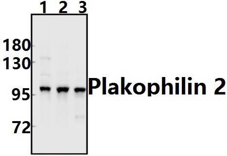 Plakophilin 2 (P663)
