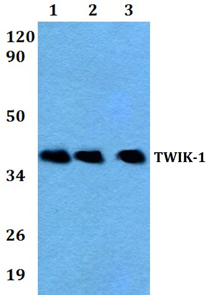 TWIK~1 (V322)